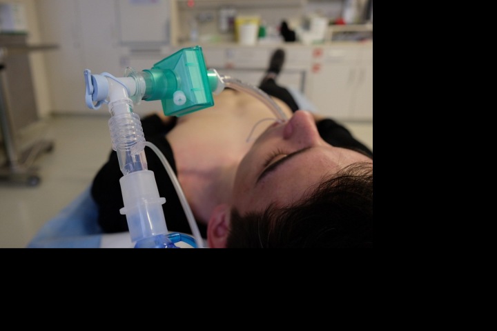 Intubace.